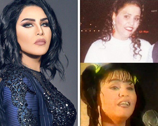 ممثلات خليجيات قبل وبعد عمليات التجميل - فنانات بعد وقبل العمليات 1326