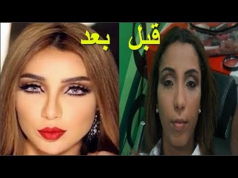 ممثلات خليجيات قبل وبعد عمليات التجميل - فنانات بعد وقبل العمليات 1326 4